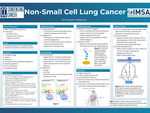 Non-Small Cell Lung Cancer by Tanmayee Vegesna '19