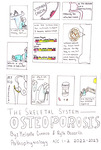 The Skeletal System – Osteoporosis