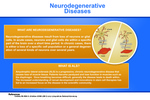 08: Neurodegenerative Diseases by Satya Yerrabolu '13 and Riva Trivedi '13